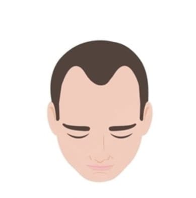 Stage 2
